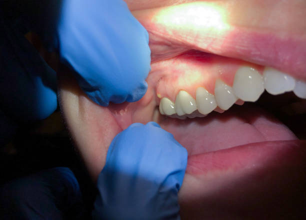 Professional Emergency Dental Service in ID